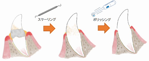 きれいになる工程.png